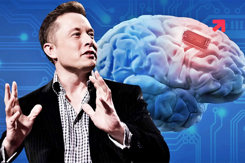 After Tesla, Elon Musk is Ready to Tickle Your Brain