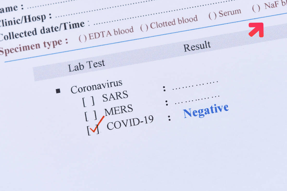 Germany’s COVID-19 Contacts Tracing Software